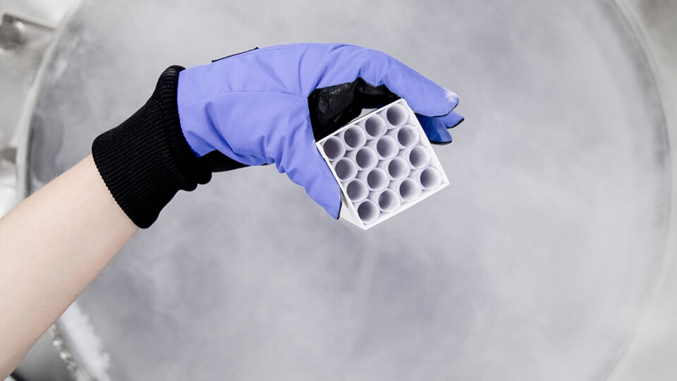 Purple gloved hand holding a medical container with holes for tubes